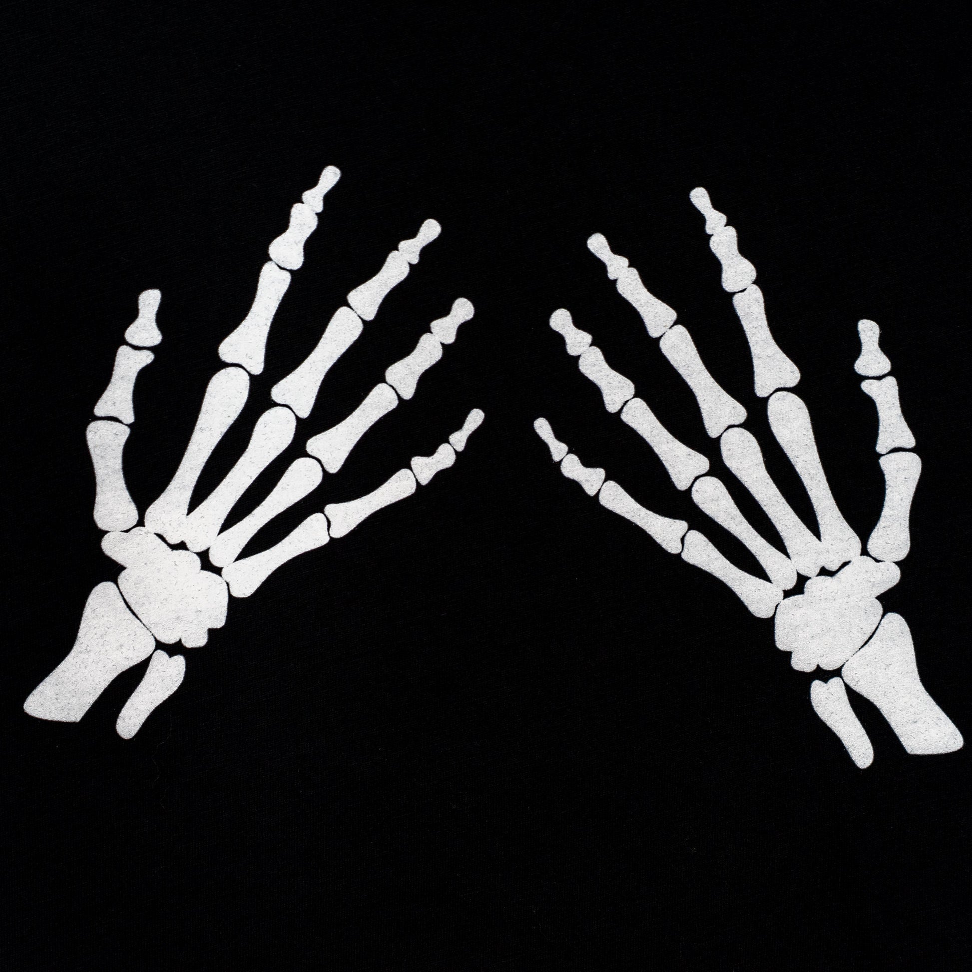 X-ray of two hands on a black background